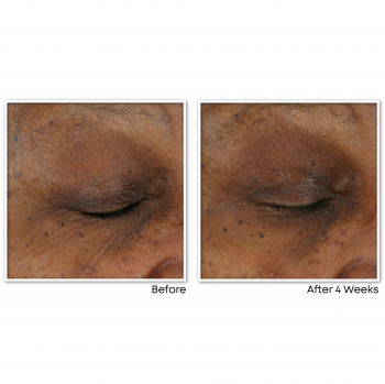 ROC-046_Before_After_VitC_1000x1000_72dpi_DE01_CB_V3__2